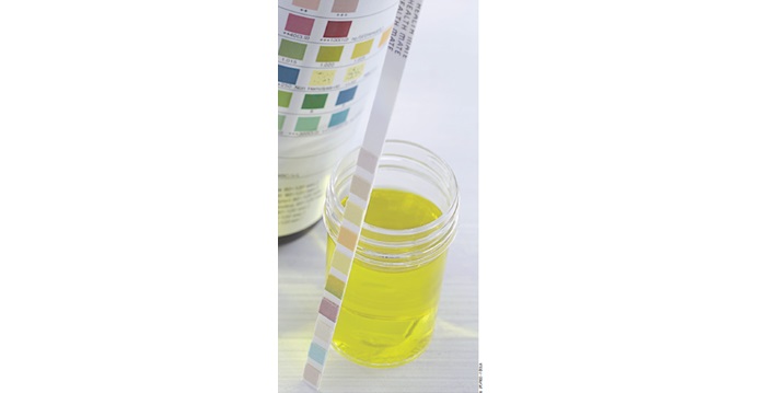 Les infections urinaires du bébé et de l’enfant