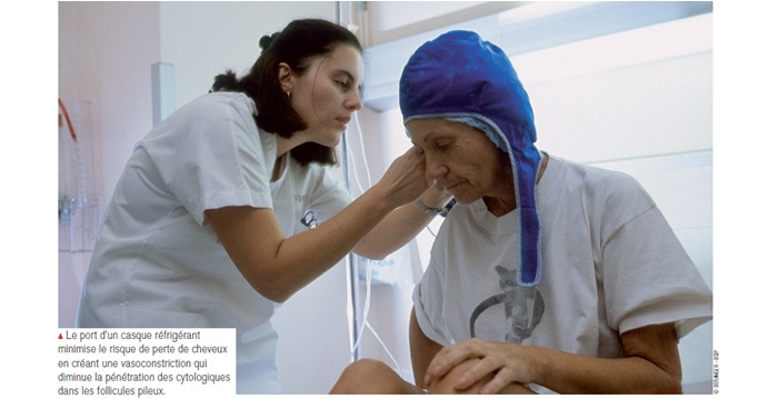 La dermotoxicité des anticancéreux