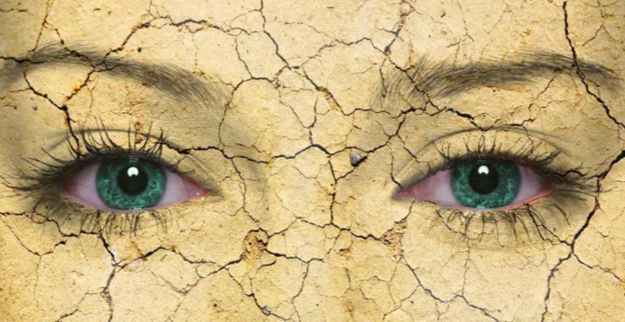 Déshydratation, gerçures, crevasses : quels conseils apporter ?