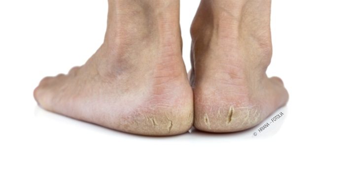 « J’ai mal au pied… »