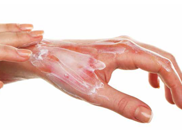 Accident domestique : « Je me suis brûlé... »