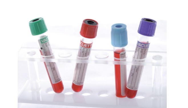 Le dépistage du diabète est-il efficace ?