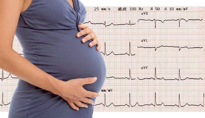 Épilepsie et grossesse, recommandations et mise à jour