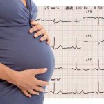 Acheter Épilepsie et grossesse, recommandations et mise à jour Épilepsie et grossesse, recommandations et mise à jour