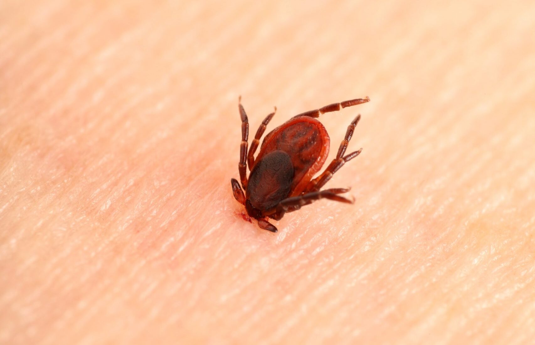 Acheter La maladie de Lyme La maladie de Lyme