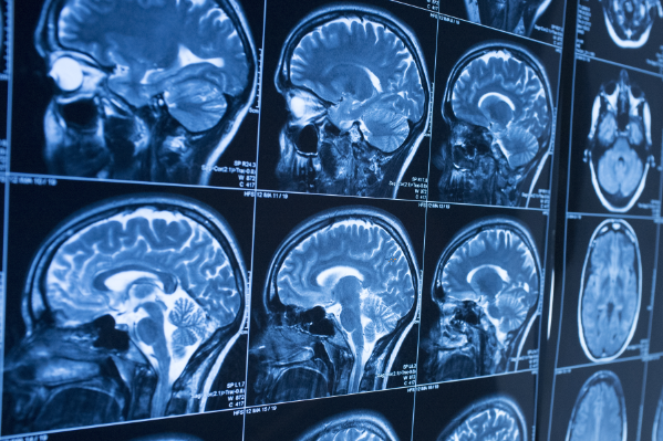 Je dois passer une radiographie, un scanner, une IRM