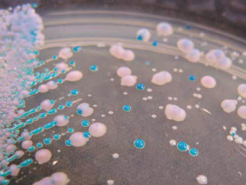 Pour ou contre : Les probiotiques pour prévenir les mycoses vaginales ?