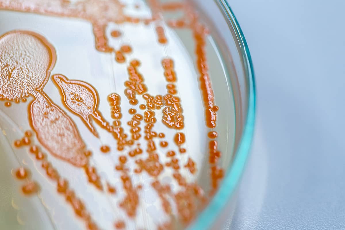 La lutte contre l’antibiorésistance à l’officine