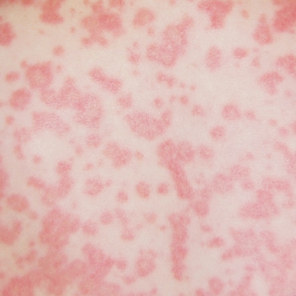 Connaître les effets indésirables des antibiotiques