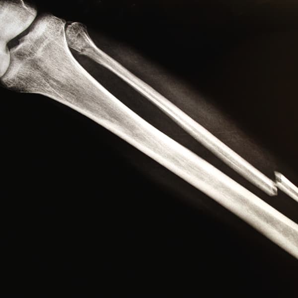 Acheter Urgences trauma : conduite à tenir Urgences trauma : conduite à tenir