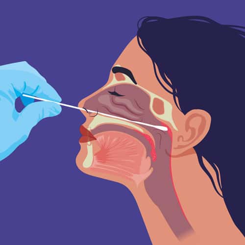 Tests antigéniques : tout ce que vous devez savoir