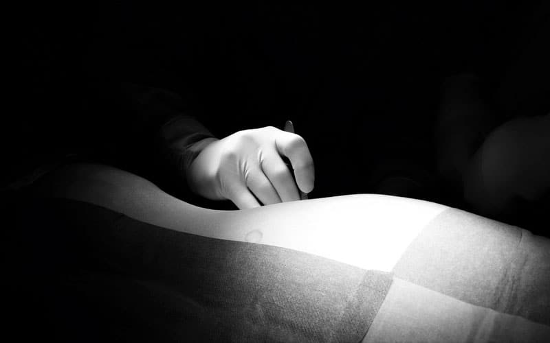 Greffe : accompagner ses patients immunodéprimés