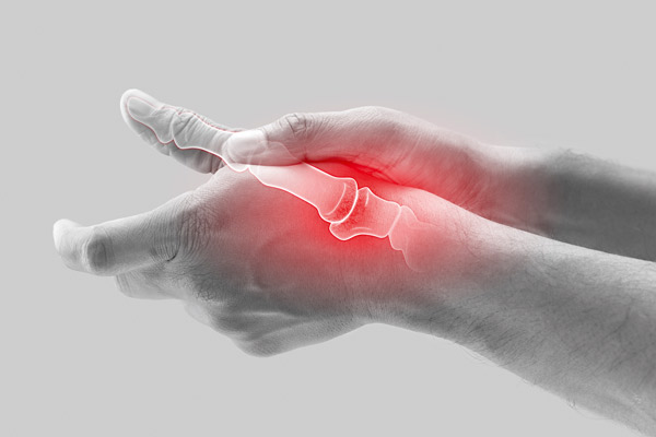 Arthrose et comorbidité cardiaque : préférer les AINS ou les anti-arthrosiques d’action lente&nbsp;?