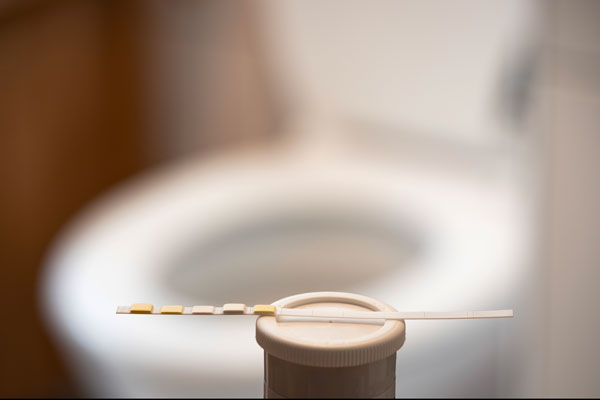 TROD angine et cystite&nbsp;: un modèle qui se cherche encore