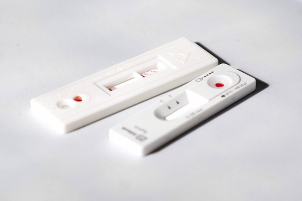 La Côte d’Azur expérimente le dépistage du VIH en pharmacie