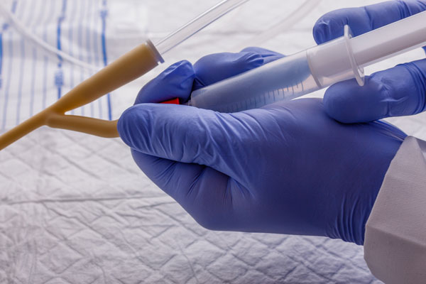 Sondage urinaire : quand et comment le pratiquer ?